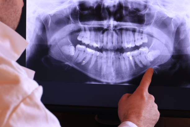 Best After-Hours Emergency Dentist in Ahtanum, WA